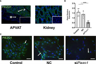 PIEZO1 mechanoreceptor activation reduces adipogenesis in perivascular adipose tissue preadipocytes